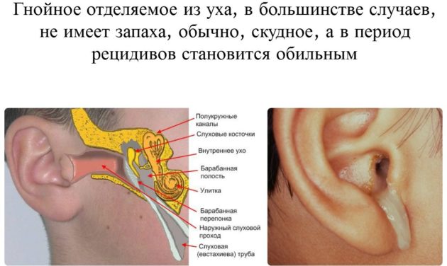 Симптоми хвороб вуха у дорослих та їх лікування