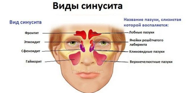 Симптоми хвороб вуха у дорослих та їх лікування