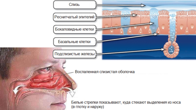Симптоми лікування сухого риніт нежиті у дорослих і дітей