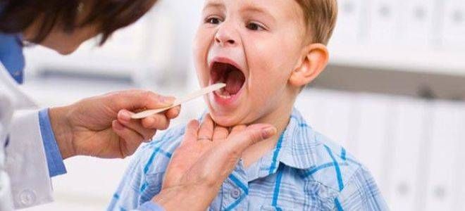 Симптоми та головні правила лікування трахеїту у дітей