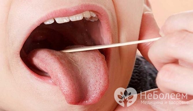 Симптоми та лікування ангіни у дітей в домашніх умовах