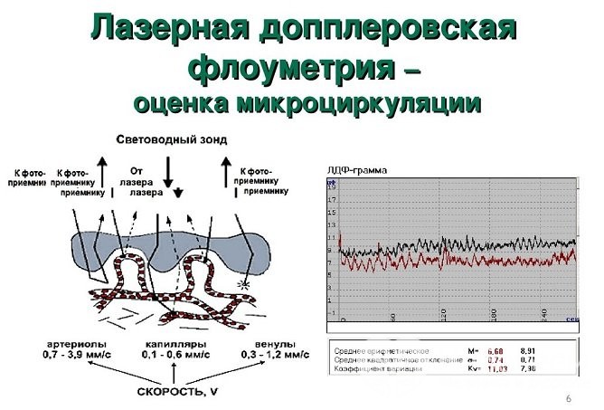 Симптоми та лікування атрофічного фарингіту