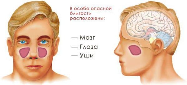 Симптоми та лікування гнійного гаймориту