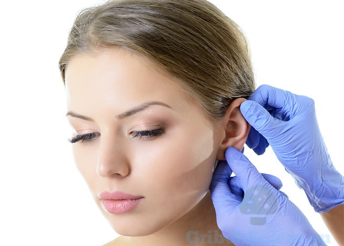 Симптоми та лікування грибка у вухах у людини