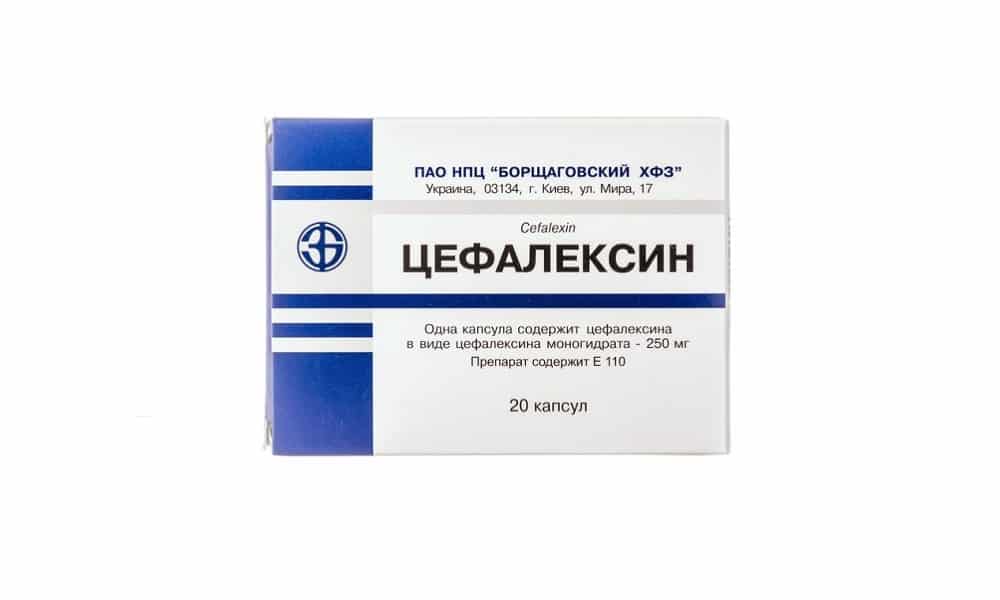 Симптоми та лікування піску в сечовому міхурі у жінок: препарати, настої трав, дієта