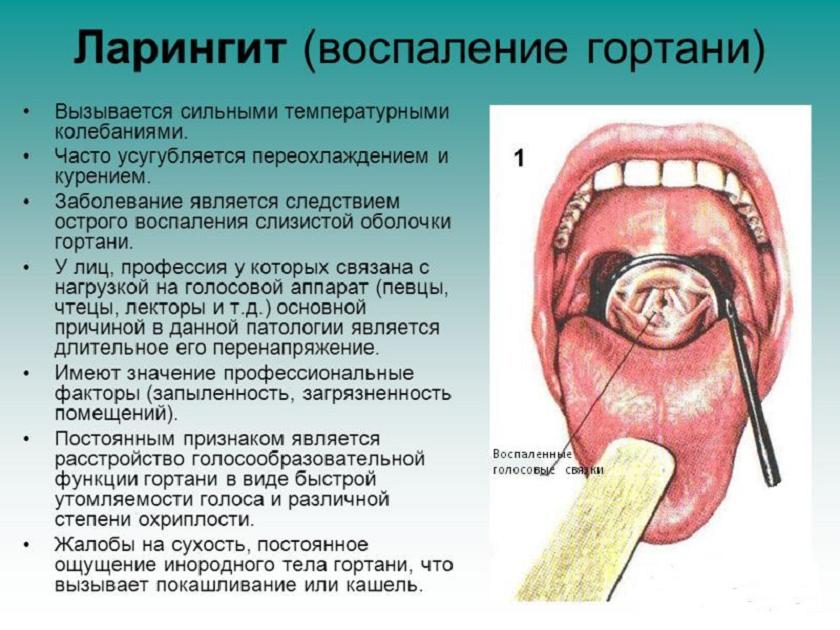 Симптоми та лікування стенозуючого ларингіту у дорослих і дітей