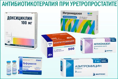 Симптоми та лікування уретриту у чоловіків