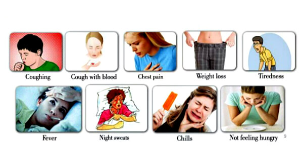 Симптоми туберкульозу на ранній стадії