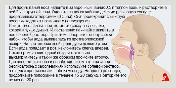 Синусит як лікувати в домашніх умовах. Чи можливо вилікувати синусит народними засобами