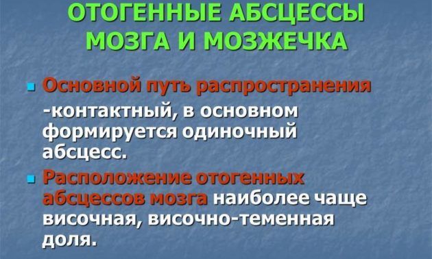 Синусит як лікувати в домашніх умовах. Чи можливо вилікувати синусит народними засобами