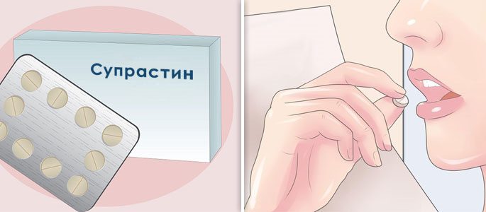 Синусит як лікувати в домашніх умовах. Чи можливо вилікувати синусит народними засобами