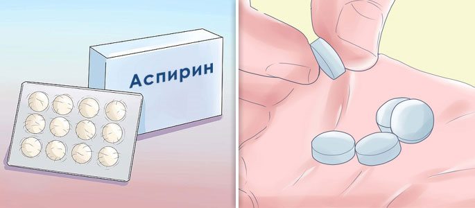 Синусит як лікувати в домашніх умовах. Чи можливо вилікувати синусит народними засобами