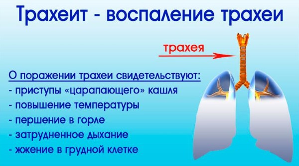 Сироп солодки від кашлю – інструкція щодо застосування сиропу для дітей і дорослих