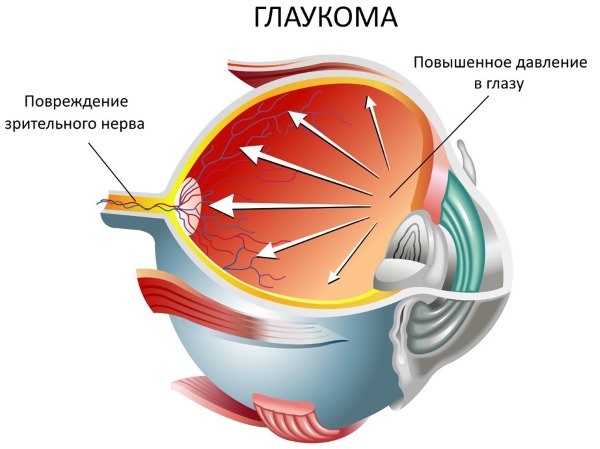 Сироп солодки від кашлю – інструкція щодо застосування сиропу для дітей і дорослих