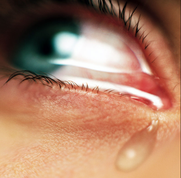 Сльозоточивість очей – причини і лікування. Як і чим вилікувати в домашніх умовах
