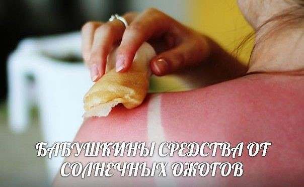Сонячний опік народні засоби