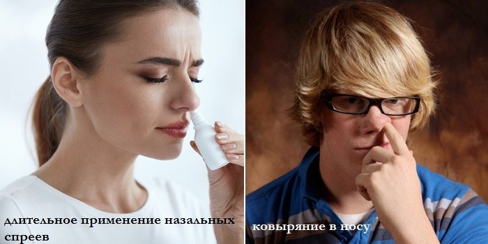 Соплі при гаймориті їх колір і як правильно сякатися