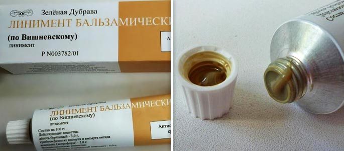 Спосіб застосування складної мазі при гаймориті Вишневського Симановского та іхтіолової