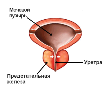 Способи лікування пахової гранульоми