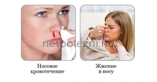 Спреї для носа (від нежитю): огляд кращих препаратів