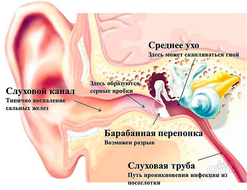 Стріляє у вусі з лівої сторони які причини