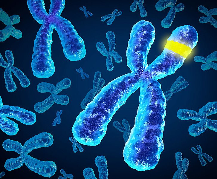 Ступеня (стадії) приглухуватості — Нейросенсорна приглухуватість