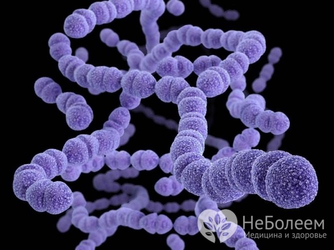 Сумамед при гнійної ангіни у дорослих