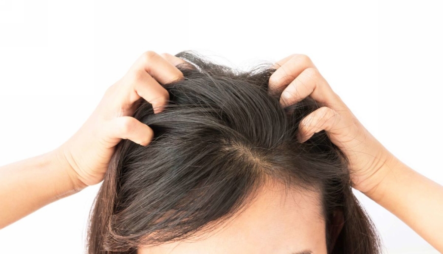 Свербіж шкіри голови основні причини і народне лікування