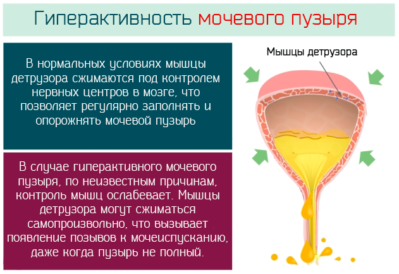 Таблетки при нетриманні сечі у жінок: особливості лікування