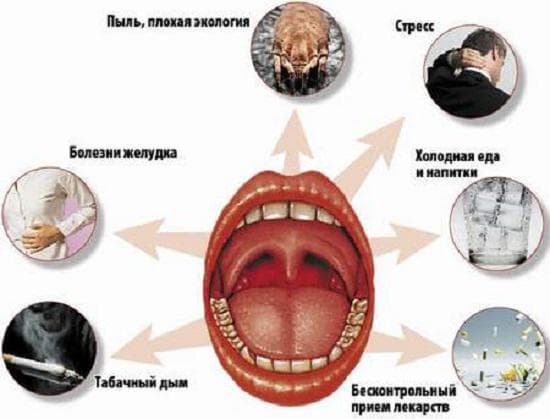 Тонзиліт – симптоми і лікування у дорослих хронічного, причини і ознаки