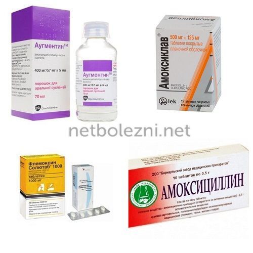 ТОП-20 ефективних і недорогих ліків від гаймориту
