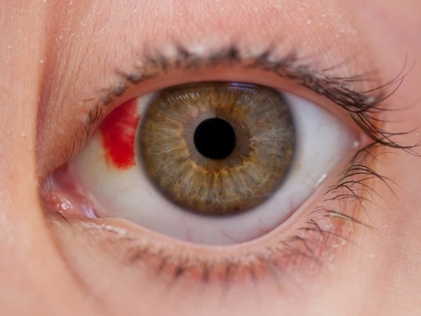 Травма ока перша допомога при травмі ока