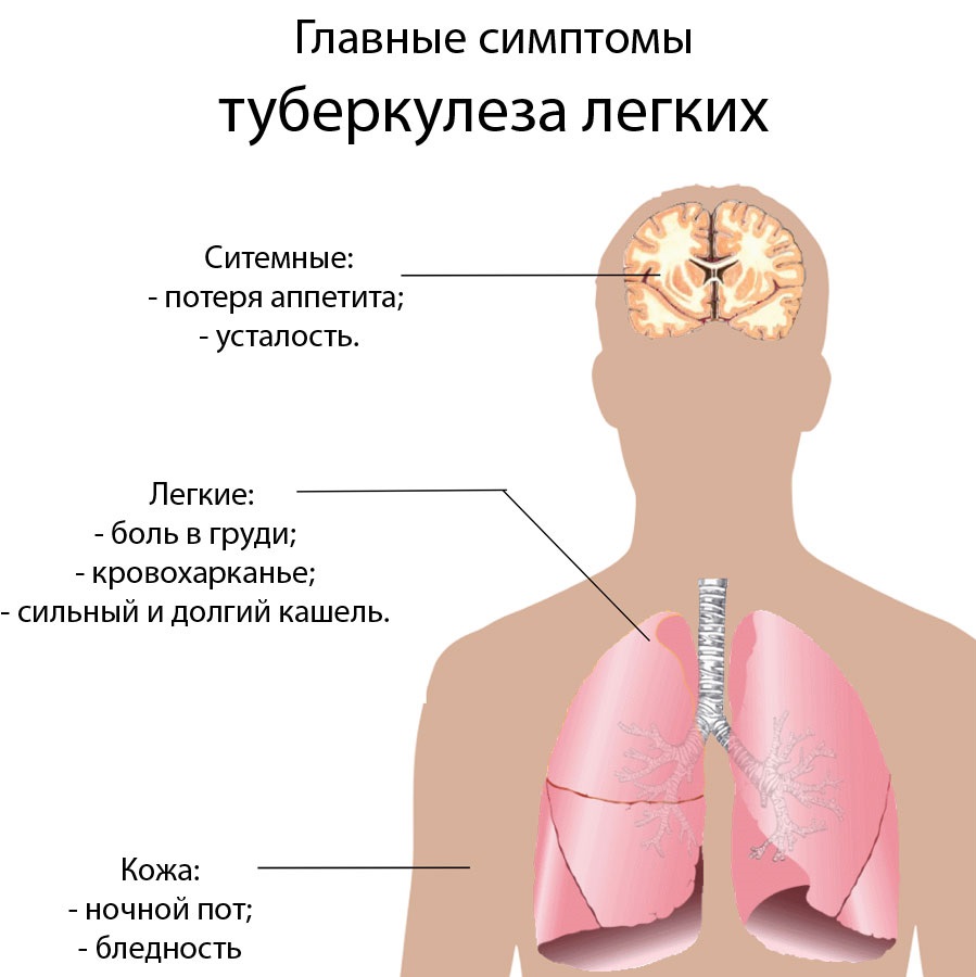 Туберкульоз легень: причини, симптоми і методи діагностики туберкульозу