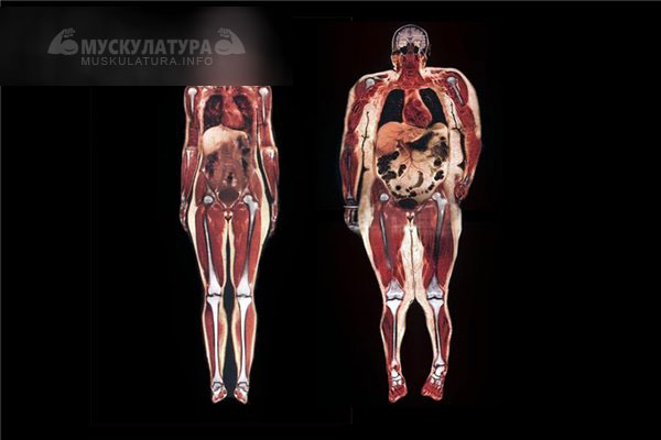 Вісцеральний жир як позбутися в домашніх умовах дієта
