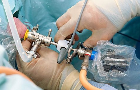 В яких випадках можливий позитивний прогноз при раку простати