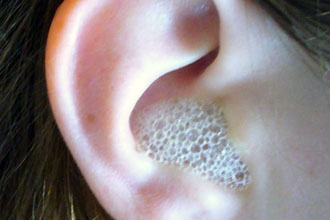 Варто заливати перекис водню у вуха при отиті та інших захворюваннях