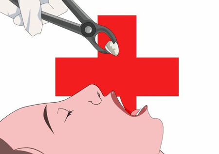Видалення мигдаликів при хронічному тонзиліті коли воно потрібно
