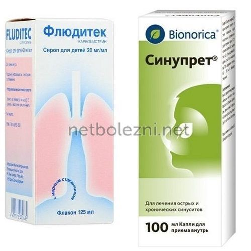 Види риносинуситу симптоми і лікування у дорослих