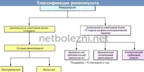 Види риносинуситу симптоми і лікування у дорослих