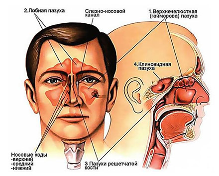 Види риносинуситу симптоми і лікування у дорослих