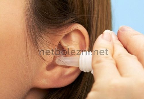Вушні краплі при закладеності вуха. Які препарати використовувати після застуди?