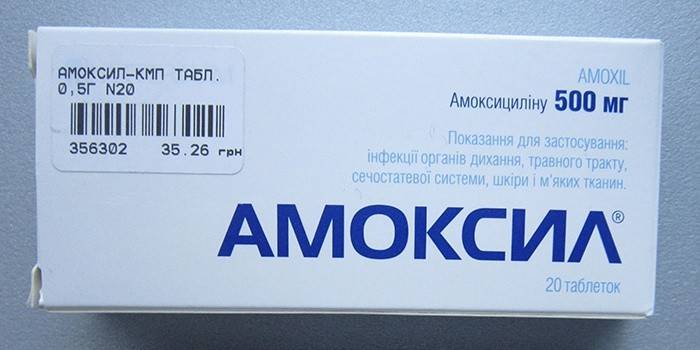 Як і чим лікувати гайморит в домашніх умовах