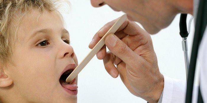 Які колють антибіотики при ангіні