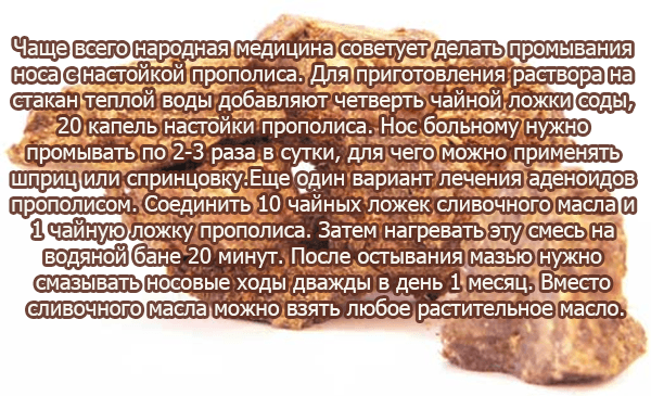 Як лікувати аденоїди у дитини в домашніх умовах народними засобами без операції