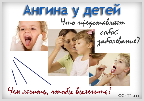Як лікувати ангіну у дитини 3 років в домашніх умовах народними засобами