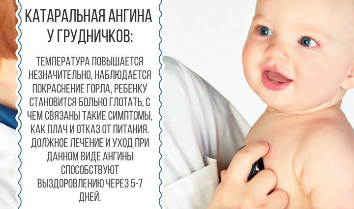Як лікувати ангіну у немовляти