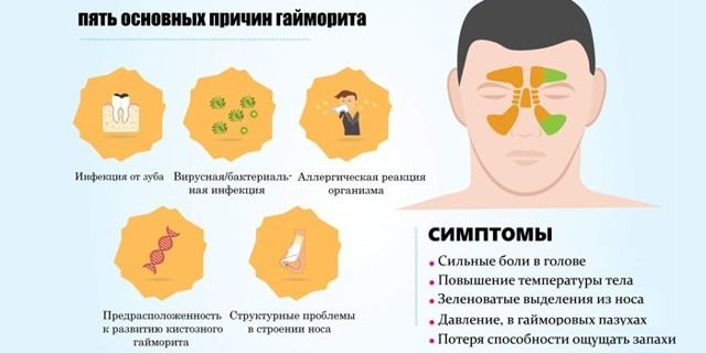 Як лікувати двосторонній гайморит у дитини і дорослого