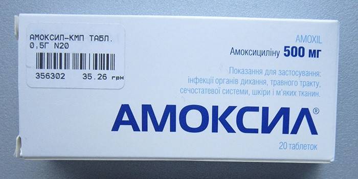 Як лікувати гайморит на початковій стадії