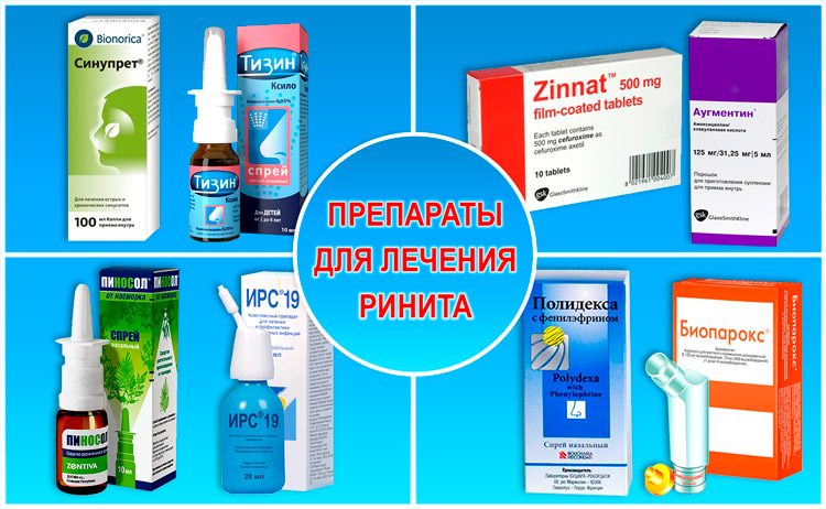 Як лікувати гнійні соплі