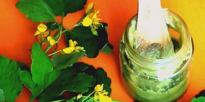 Як лікувати грибок стопи в домашніх умовах